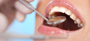 Buvez bien, buvez malin pour vos dents!